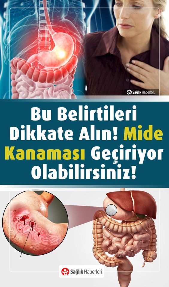 mide duvarı kalınlaşmasının belirtileri nelerdir