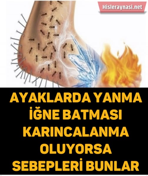 Ayak Yanması Neden Olur? İşte Sebepleri - 1