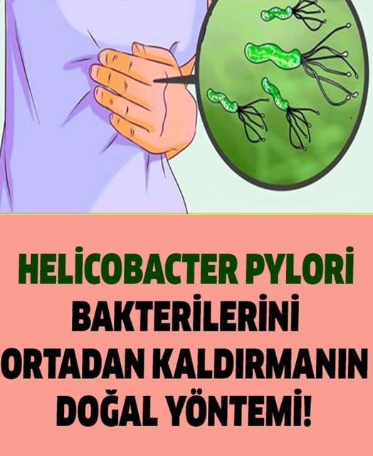 Mideden Bakterileri Ortadan Kaldırmanın Doğal Yöntemi - 1