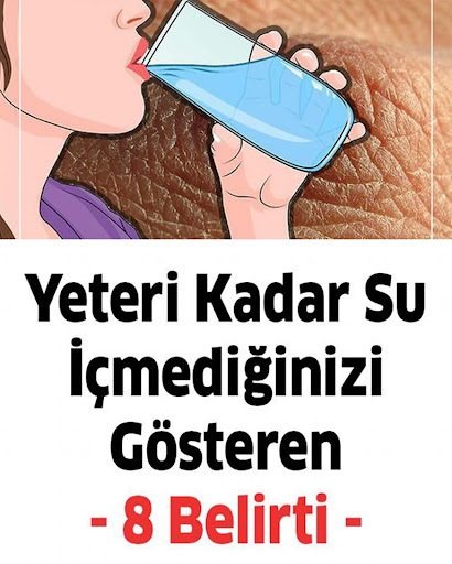 Yeteri kadar su içmediğinizde başınıza bunlar gelir - 1