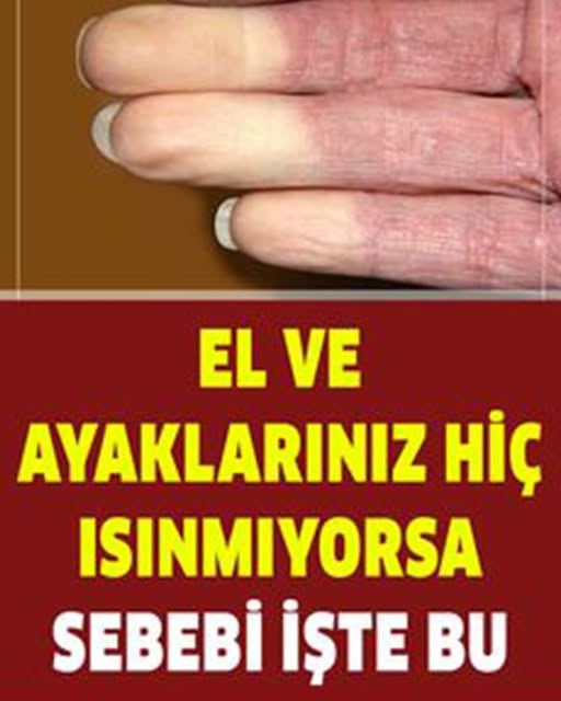 El ve Ayaklarınız Hiç Isınmıyorsa Sebebi - 3