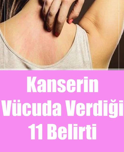 Kanserin Vücuda Verdiği 11 Belirti - 3