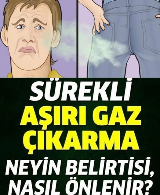 Sürekli gaz çıkarmak neyin belirtisidir? - 1