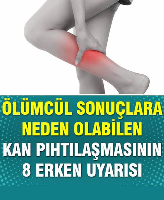 Kan Pıhtılaşmasının 8 Erken Belirtisi - 2