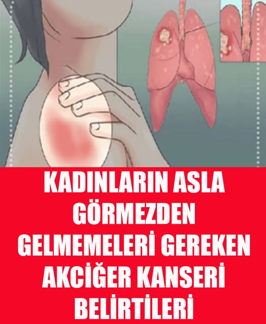 Kadınlarda belirtileri nelerdir - 1
