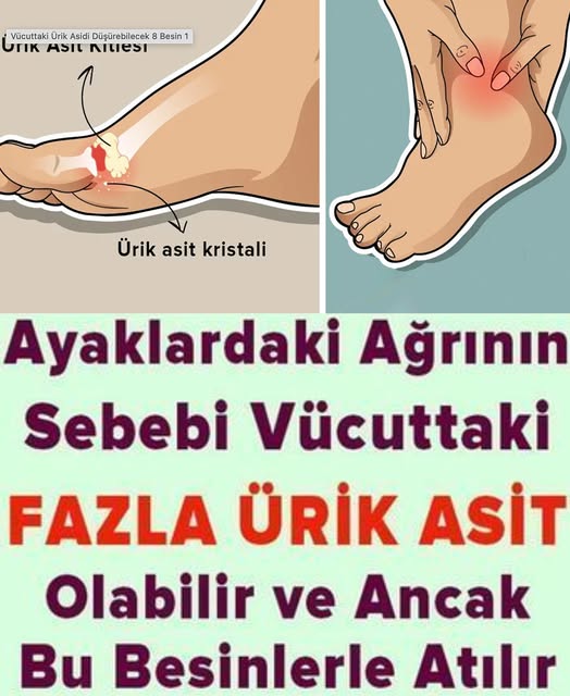 Ayaklardaki Ağrının Sebebi Ürik Asit Olabilir - 2