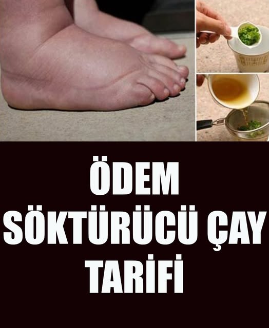 Ödem Söktürücü Çay Tarifi - 2
