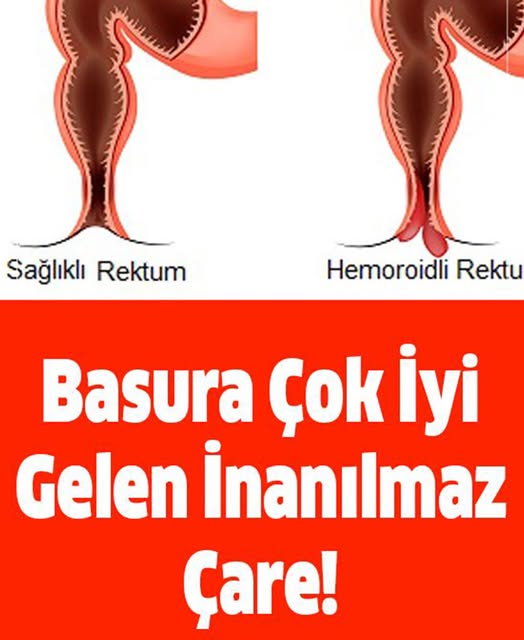 Basura iyi gelen inanılmaz yöntem - 2