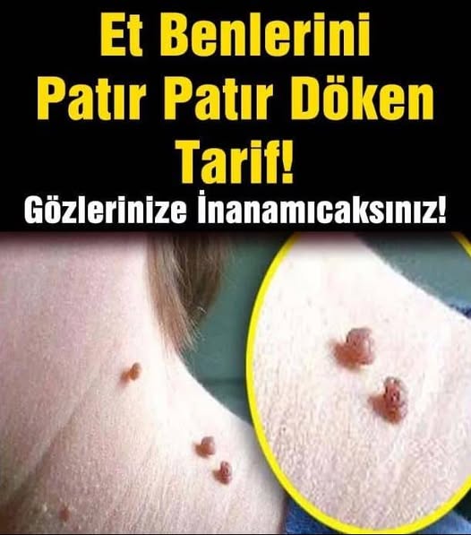 ET BENLERİNİZİ PATIR PATIR DÖKEN TARİF - 1