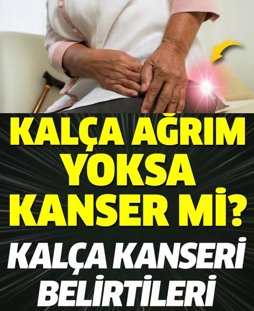 Kalça ağrım kanser mi? Kalça kanseri belirtileri - 2