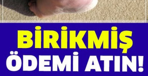 Bedeninizdeki Birikmiş Ödemi Atmak Ne Kadar Faydalı? 