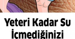 Yeteri kadar su içmediğinizde başınıza bunlar gelir