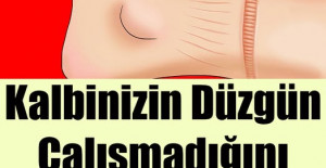 Kalbinizin Düzgün Çalışmadığını Gösteren Belirtiler	