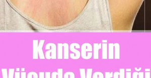 Kanserin Vücuda Verdiği 11 Belirti
