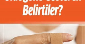 D Vitaminin Eksikliğini Gösteren Belirtiler	