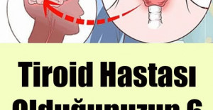 Tiroid Hastası Olduğunuzun 6 Saklı İşareti 