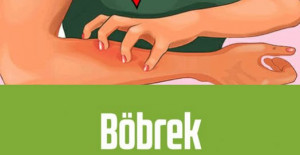 Böbrek Sorunlarının Erken Belirtileri 