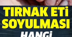 Tırnak Soyulması Hangi Hastalığın Belirtisi	