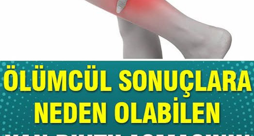 Kan Pıhtılaşmasının 8 Erken Belirtisi 