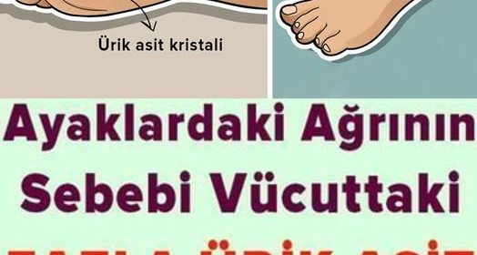 Ayaklardaki Ağrının Sebebi Ürik Asit Olabilir