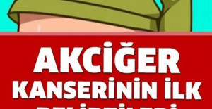 Akciğer Kanserinin Belirtilerini Öğrenin ve Önlemlerini Alın 