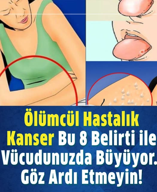 Kanserin Vücuda Verdiği 8 Belirti - 1