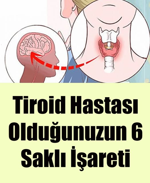 Tiroid Hastası Olduğunuzun 6 Saklı İşareti - 1