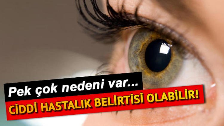 Göz seğirmesi neden olur? Göz seğirmesi nasıl geçer?
