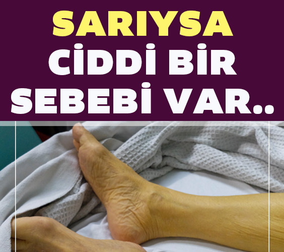 Ayak sararması neden olur