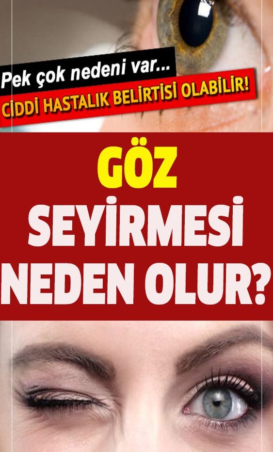 Göz seğirmesi neden olur? Göz seğirmesi nasıl geçer?